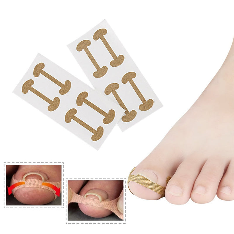 PROFESSIONAL HEALTH 20pcs Professional Nail Care Embedded Toe Nail Corrector Sticker Toenail Care Pedicure Thumb Curl Correction Sticker Foot Care