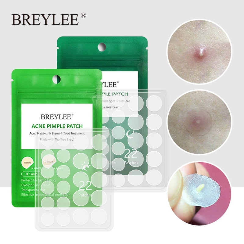 BREYLEE Acne Pimple Patch  Stickers Acne Treatment Pimple Remover Tool Blemish Spot Facial Mask Skin Care  Waterproof 22 Patches