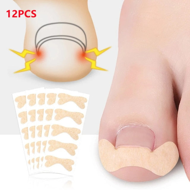 【HOT SALE】12pcs Ingrown Toe Nail Correction Wire Fixer Pedicure Paronychia Recover Toenails Corrector Foot Care Tool