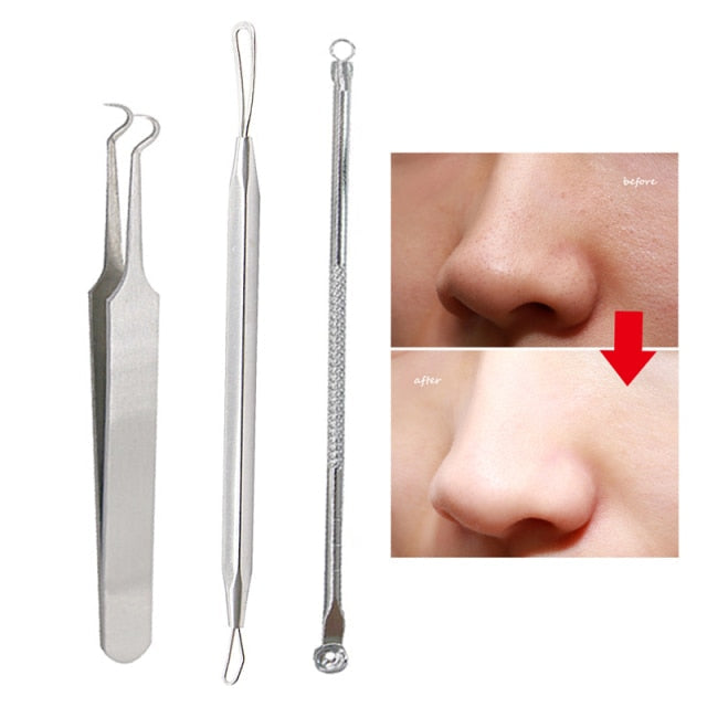 Blackhead Remover Needles Tool Black Dot Pimple Treatment Squeezing Acne Extractor Spoon Tools Face Care Comedone Pore Cleaner