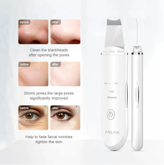 Ultrasonic Skin Scrubber Deep Face Cleaning Machine Peeling Shovel Facial Pore Cleaner Face Skin Scrubber Lift Machine